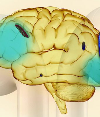 Bezdrátová sluchátka AirPods vyžařují radiaci do vašeho mozku