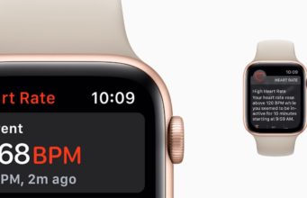 Máte nové Apple Watch? Zapněte si tyto funkce, abyste je využili naplno